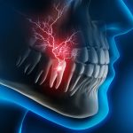 Durerea dupa Implant Dentar