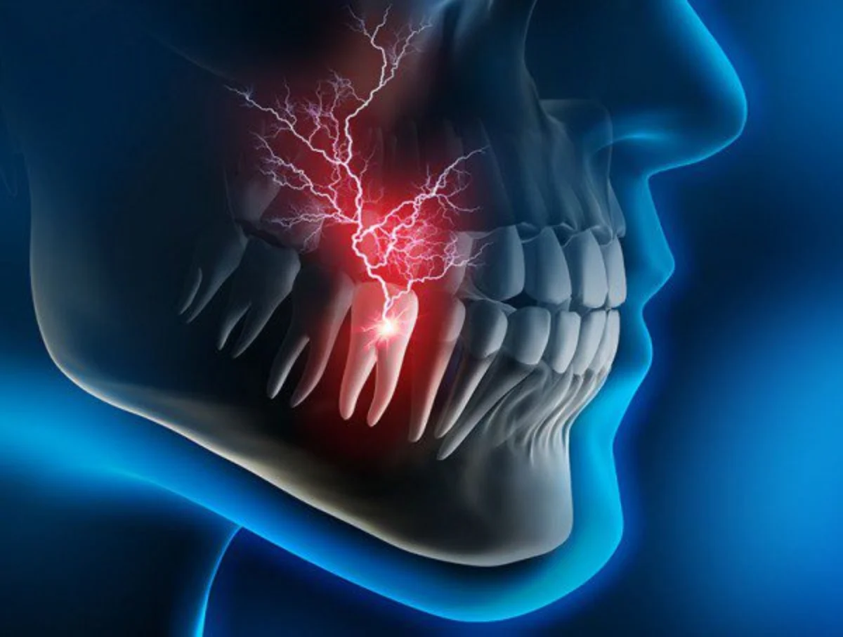 Durerea dupa Implant Dentar