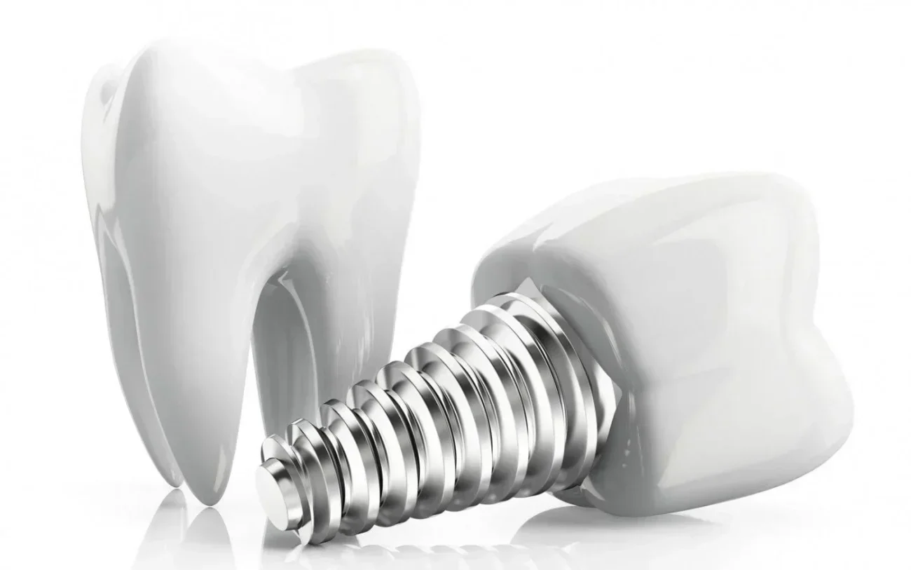 Etape Implant Dentar 1 Etape Implant Dentar