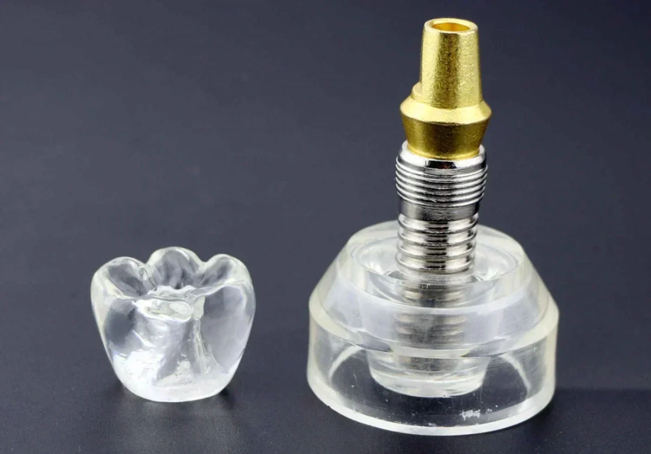 Întrebări și răspunsuri despre implantul dentar 6 Întrebări și răspunsuri despre implantul dentar