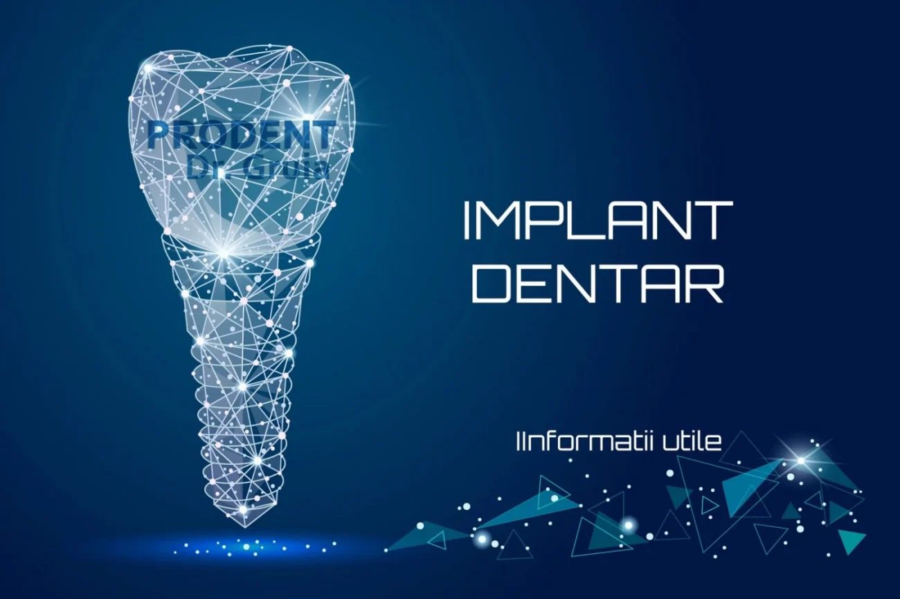 Implant dentar- Informații utile 1 Implant dentar- Informații utile