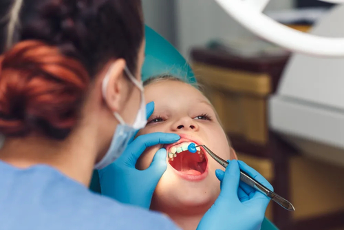 Fluorizarea dinților la copil pentru prevenirea cariilor la Clinica Prodent Dr. Gruia Câmpina