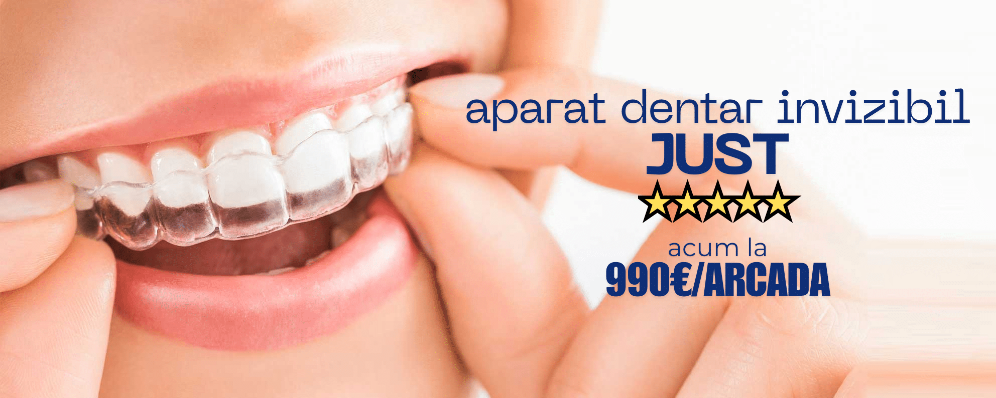 aparat dentar JUST banner