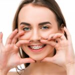 aparat dentar pret
