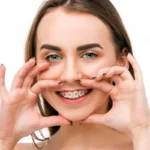 aparat dentar pret