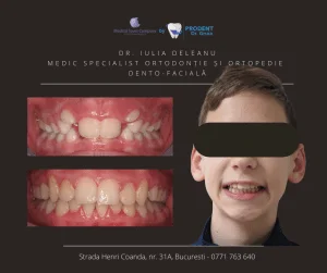 caz ortodontie Prodent Dr Gruia