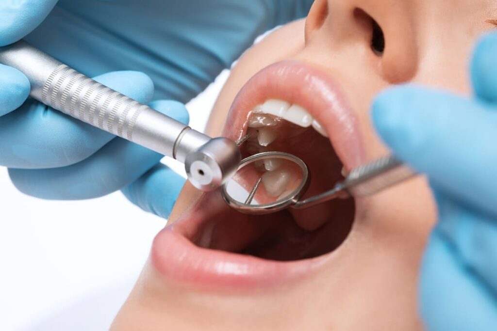 Tratamente dentare personalizate