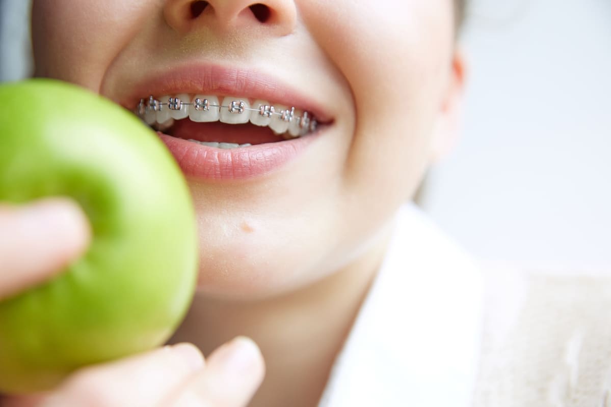 muscatura corecta cu aparat dentar