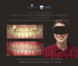 caz ortodontie Prodent Dr Gruia