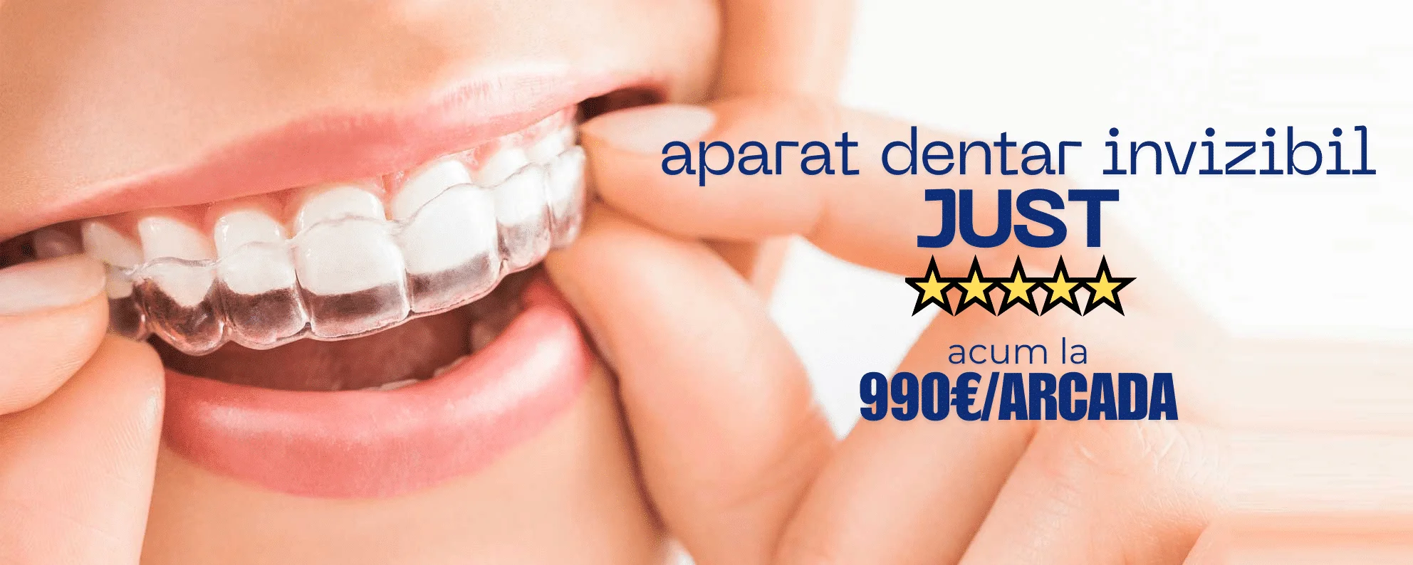 Aparat dentar invizibil JUST