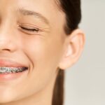 adolescenta cu aparat dentar care zambeste