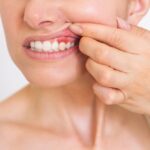 femeie cu gingii inflamate care se confrunta cu paradontoza 