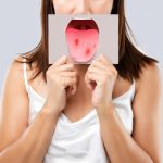 Medic stomatolog examinează cavitatea orală pentru depistarea cancerului bucal la Clinica Stomatologică Prodent Dr. Gruia