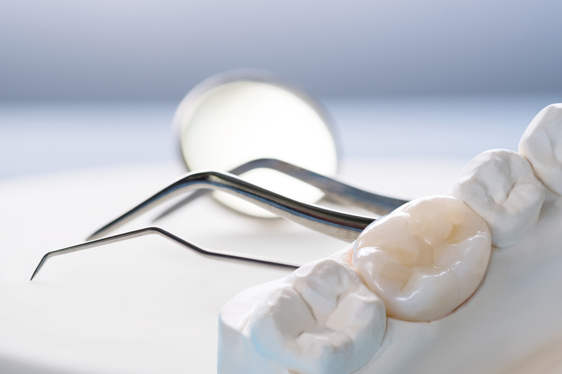 Coroană dentară din zirconiu cu aspect natural pentru restaurarea unui dinte